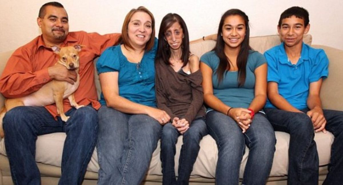 Who Is Lizzie Velasquez’s Husband? Complete Details About Her Personal Life, Career, and Inspiring Journey